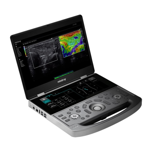 Портативный УЗИ аппарат Mindray MX8 Exp