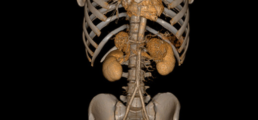 Компьютерный томограф ADVIN Ventum 32S