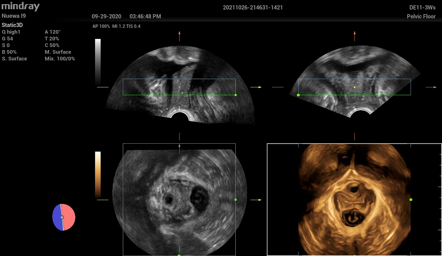 Ультразвуковой аппарат Mindray Imagyn I9