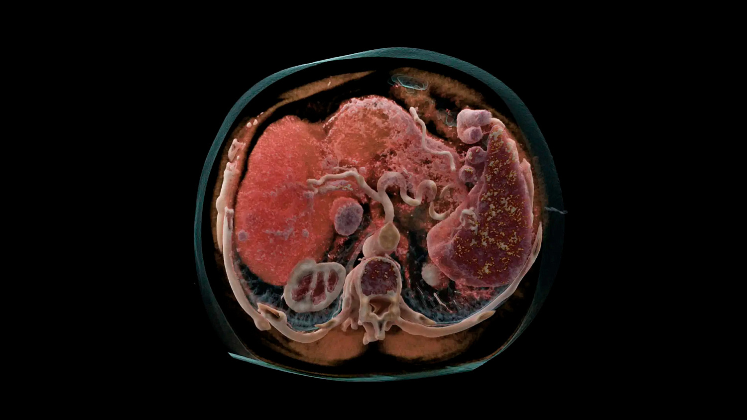 Компьютерный томограф Siemens NAEOTOM Alpha