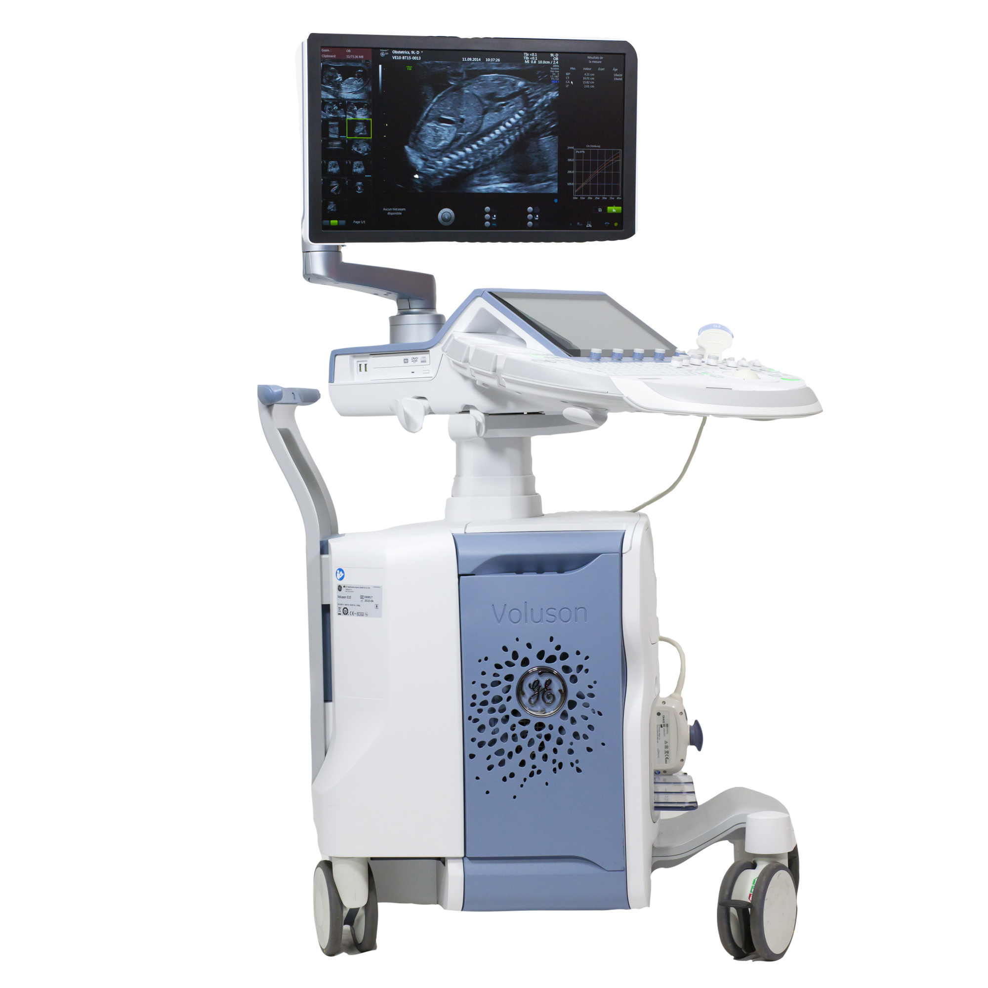 УЗИ аппарат GE Voluson E8