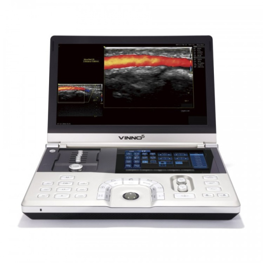 Портативный УЗИ аппарат VINNO 5
