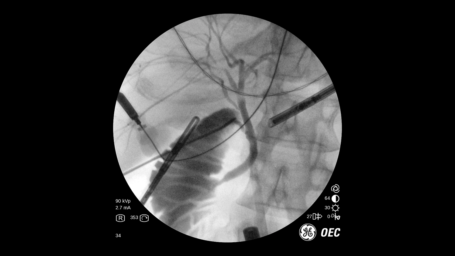 Мобильный рентгеновский аппарат с С-дугой GE OEC One