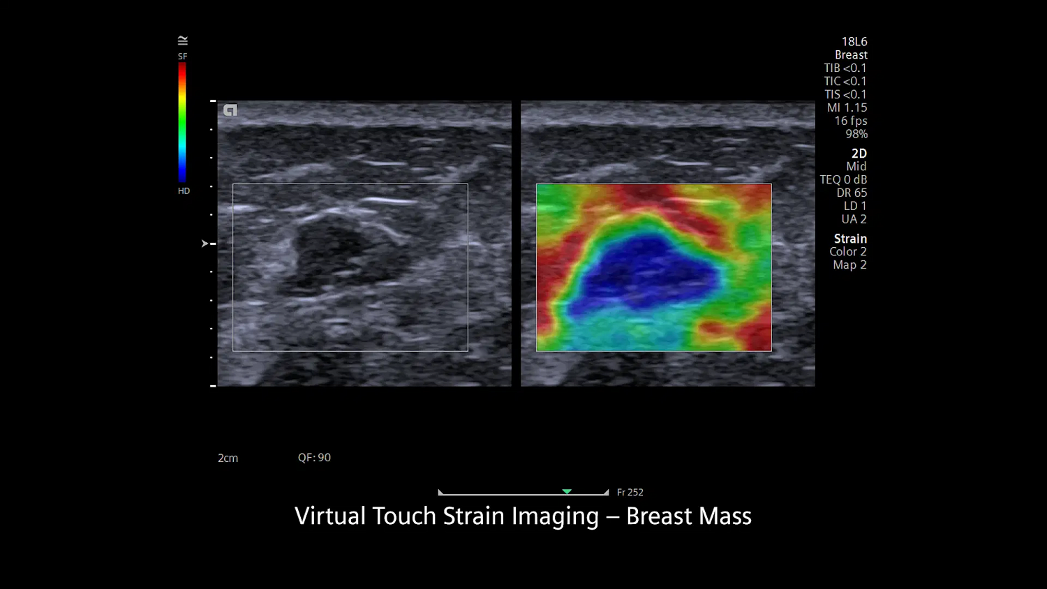 Ультразвуковая система Siemens ACUSON Redwood