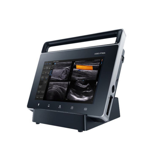 УЗИ аппарат Samsung PT60