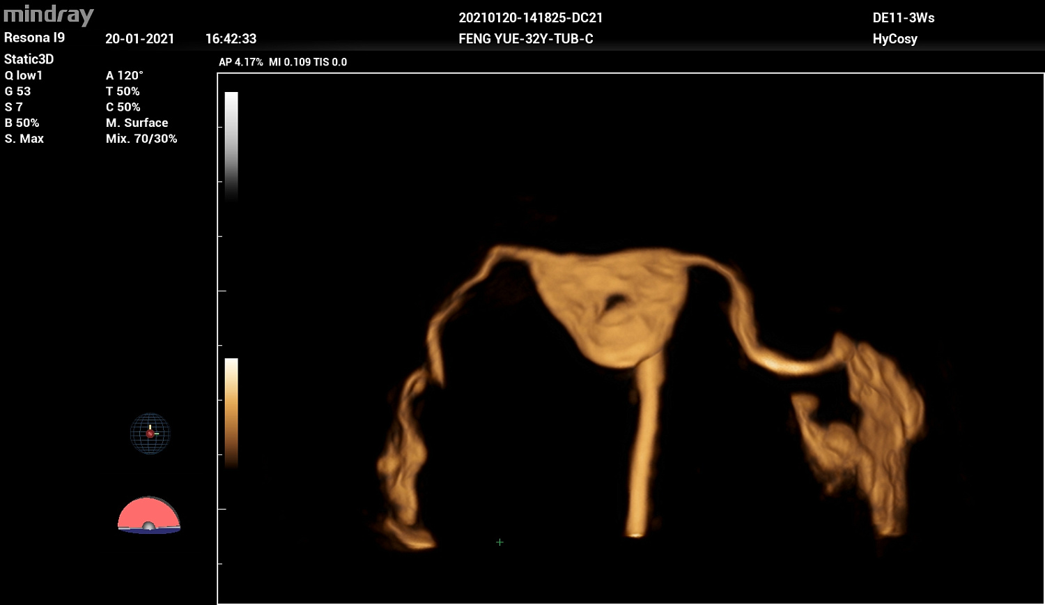 Ультразвуковой аппарат Mindray Imagyn I9