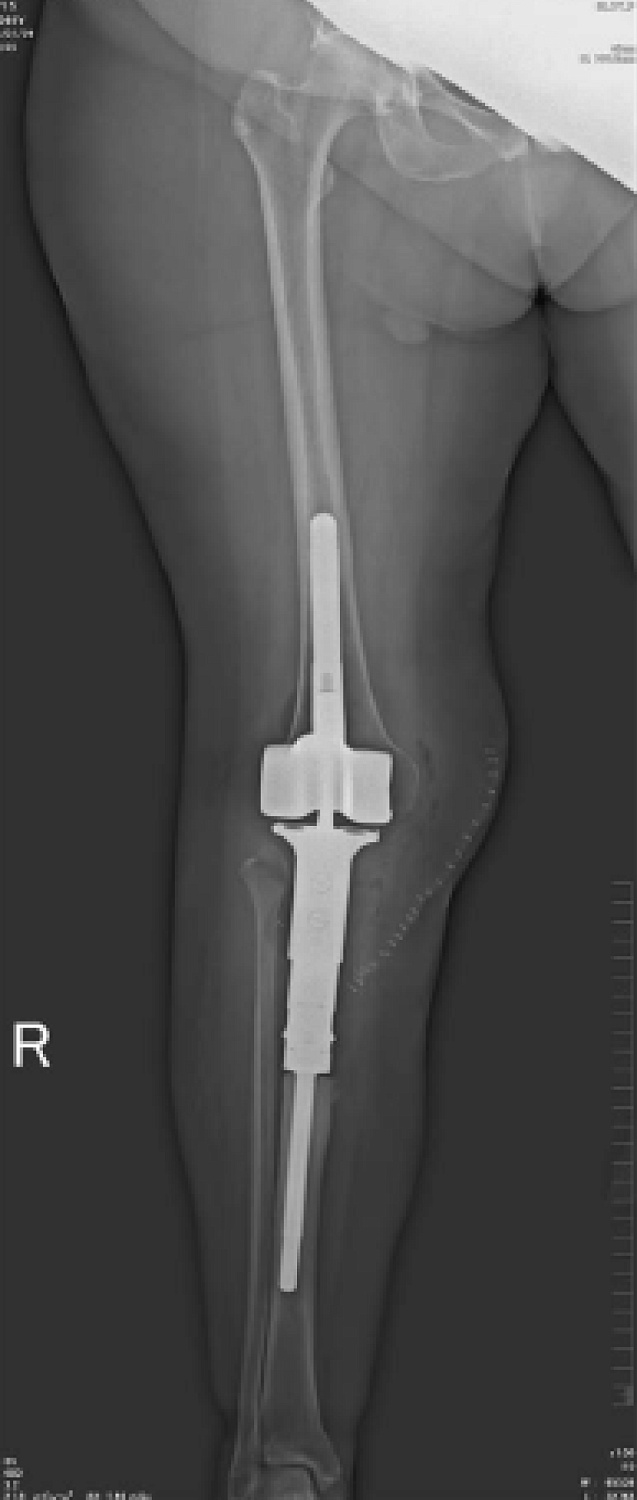 Цифровой рентгеновский комплекс Электрон MIBEL