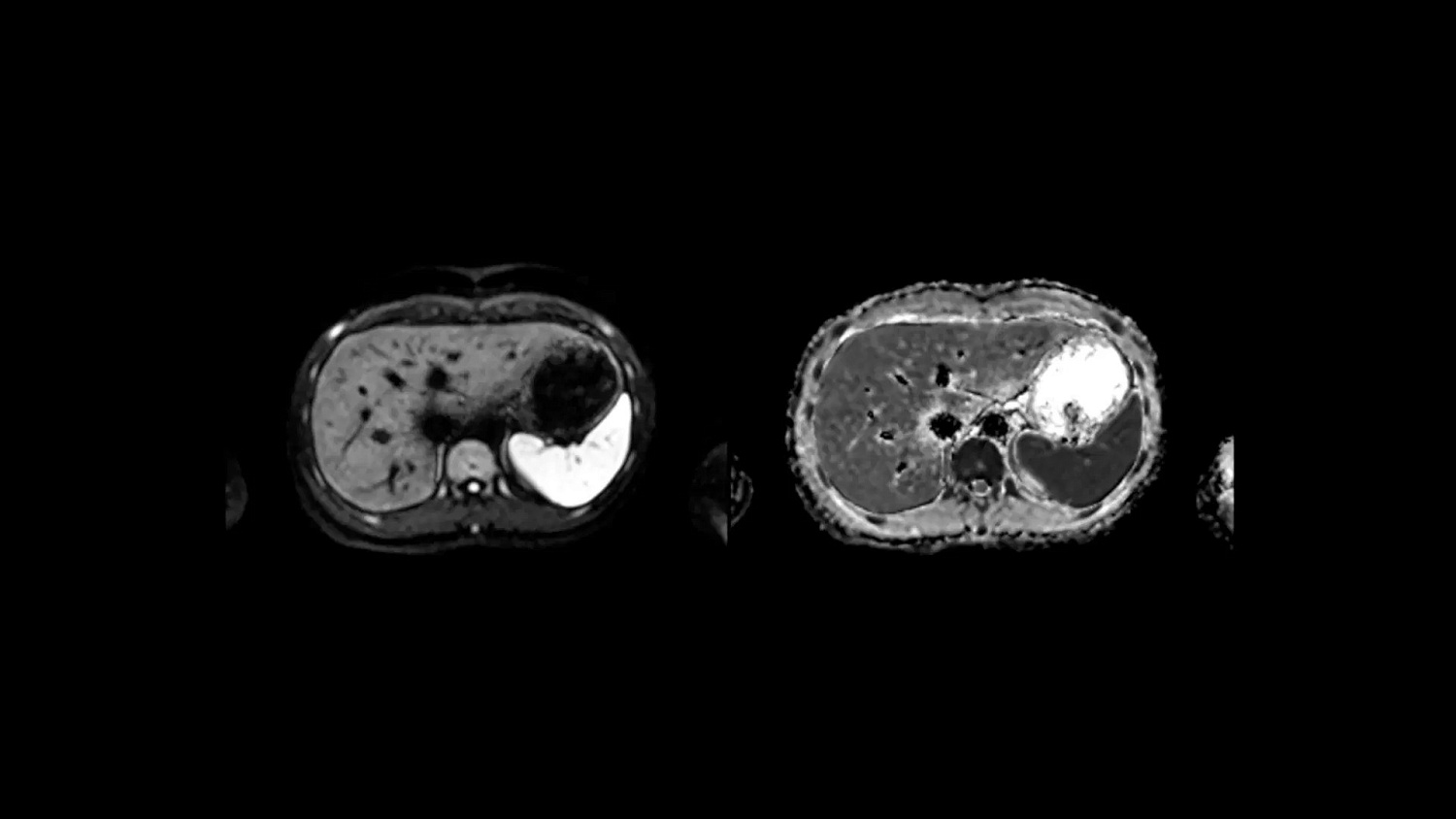 Магнитно-резонансный томограф Siemens MAGNETOM Altea