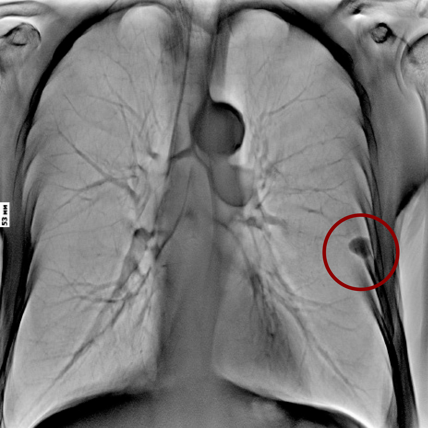 Цифровой рентгеновский комплекс Электрон MIBEL
