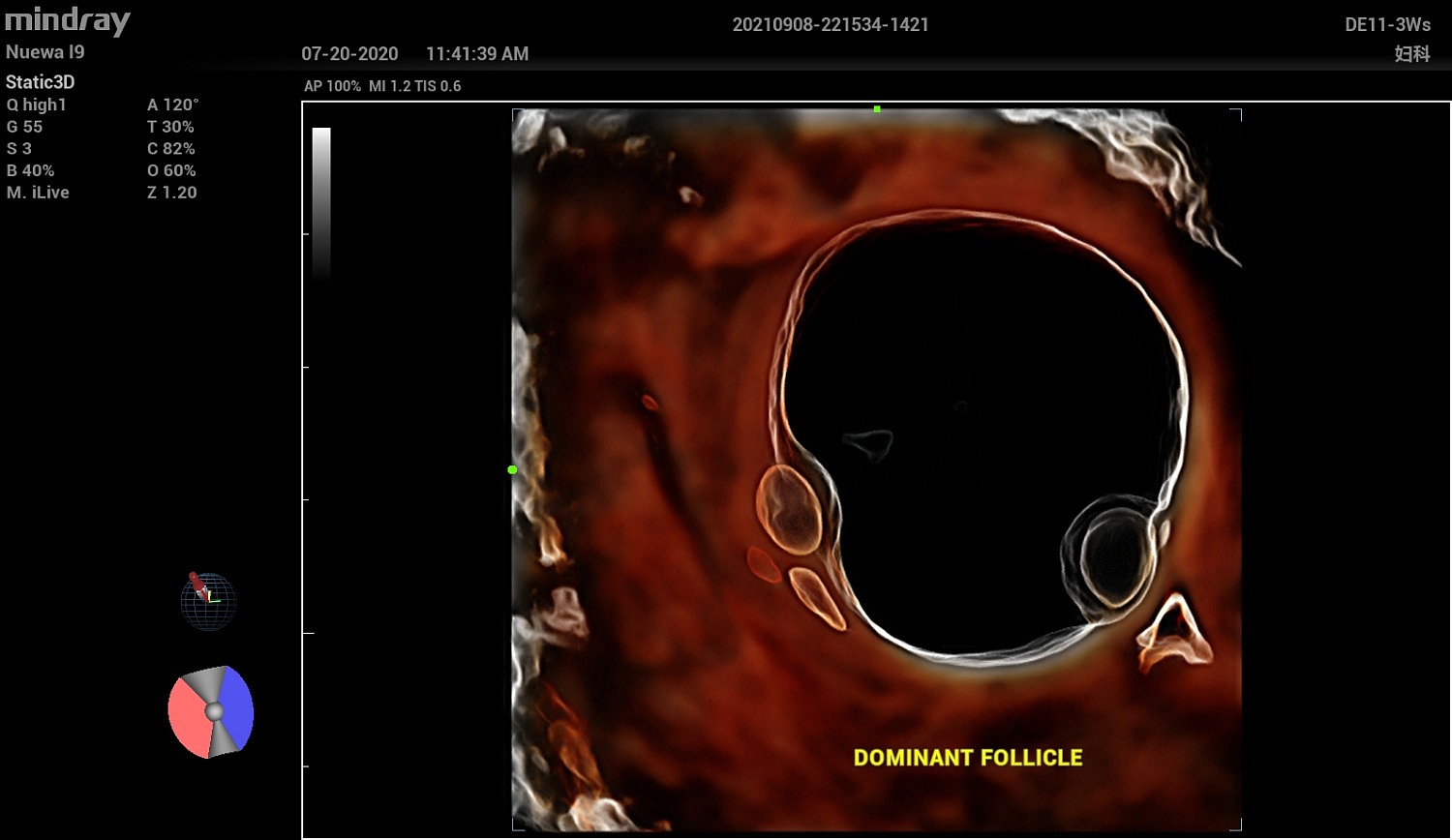 Ультразвуковой аппарат Mindray Imagyn I9