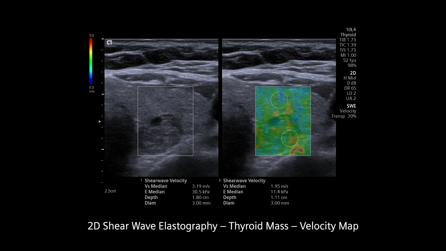 Ультразвуковая система Siemens ACUSON Redwood