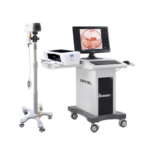 Видеокольпоскоп Kernel KN-2200