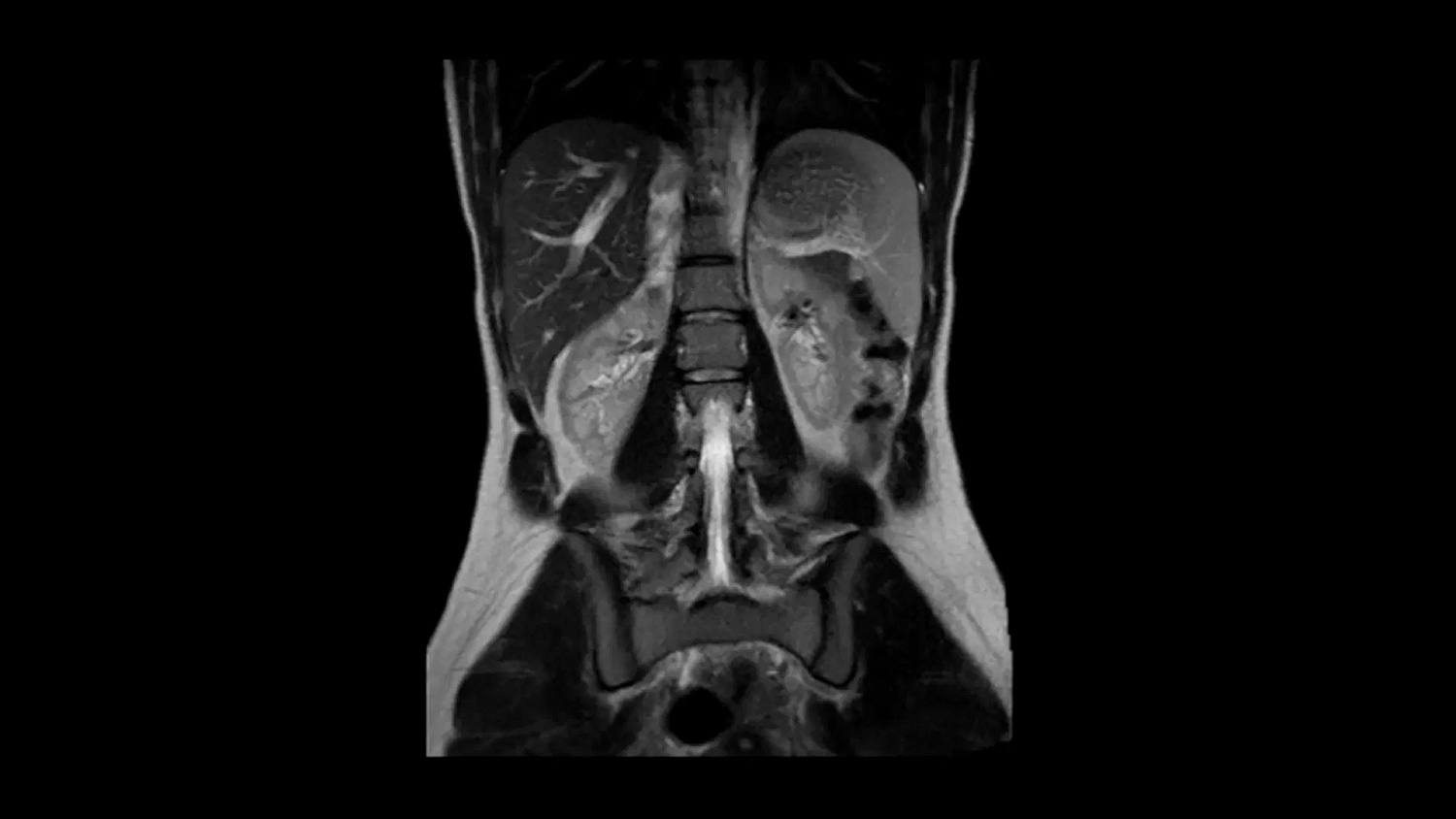 Магнитно-резонансный томограф Siemens MAGNETOM Altea