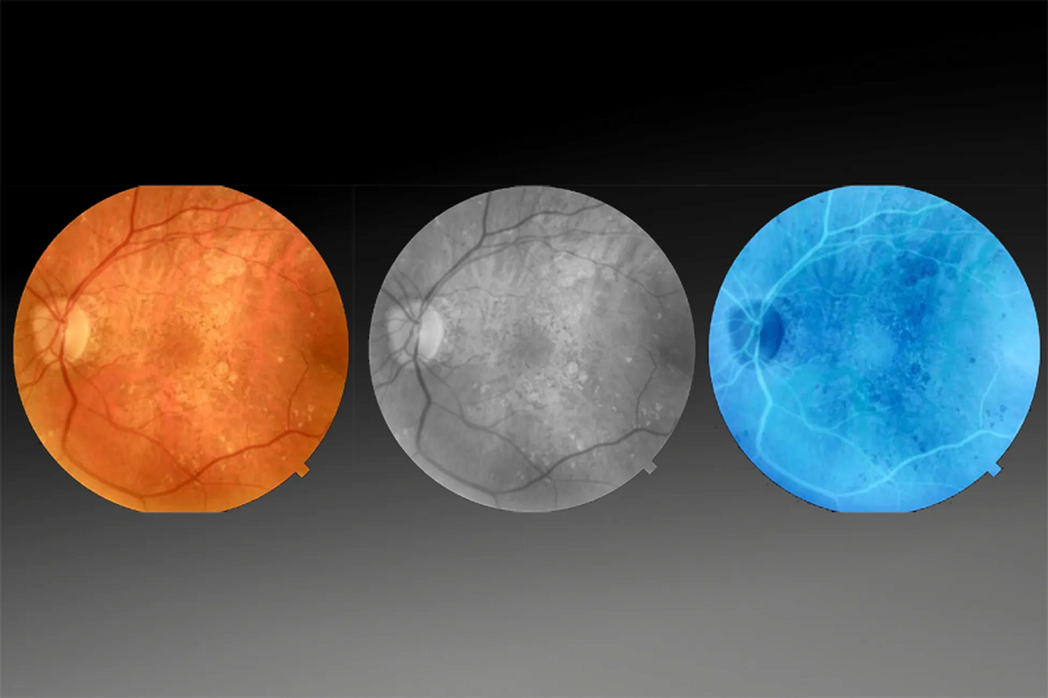 Optovue SOLIX