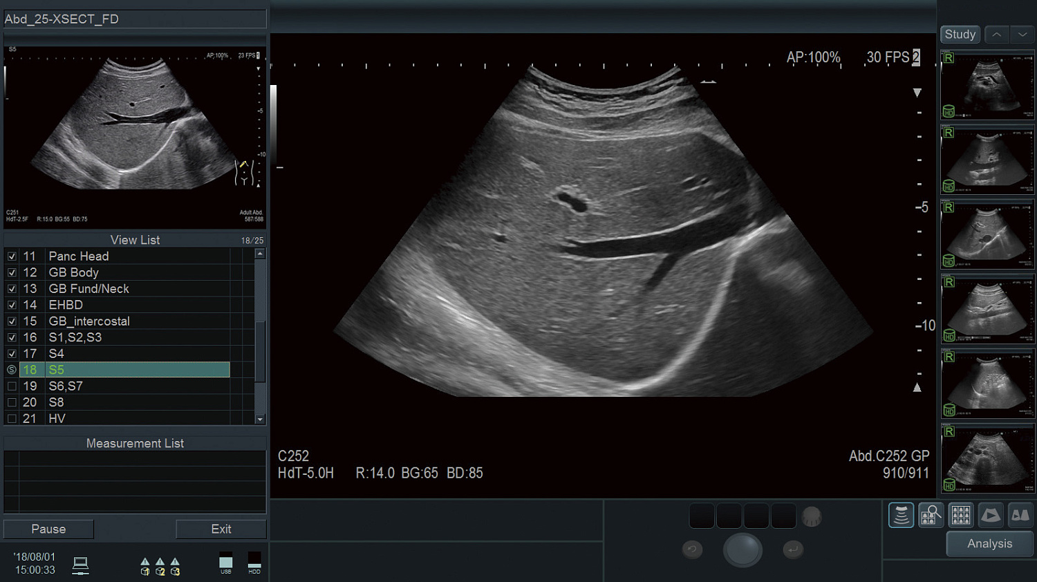 УЗИ аппарат Fujifilm (Hitachi) Arietta 750SE
