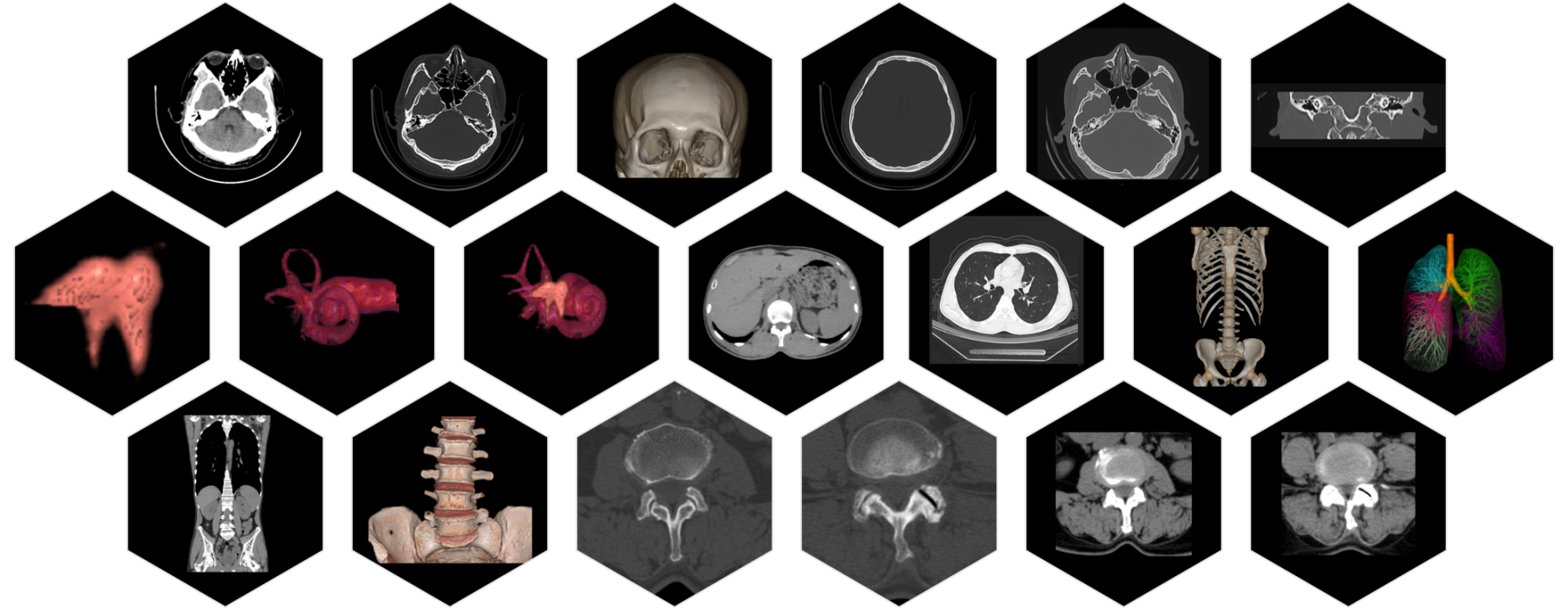 Компьютерный томограф SinoVision Alpha CT Series