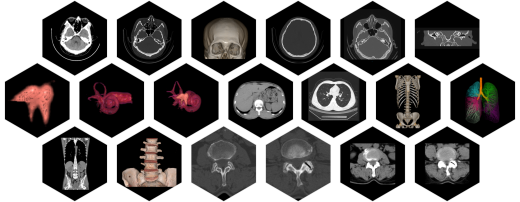 Компьютерный томограф SinoVision Alpha CT Series