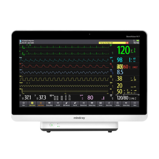 Монитор пациента Mindray BeneVision N17