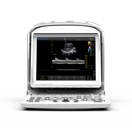 УЗИ аппарат CHISON ECO 3 Expert