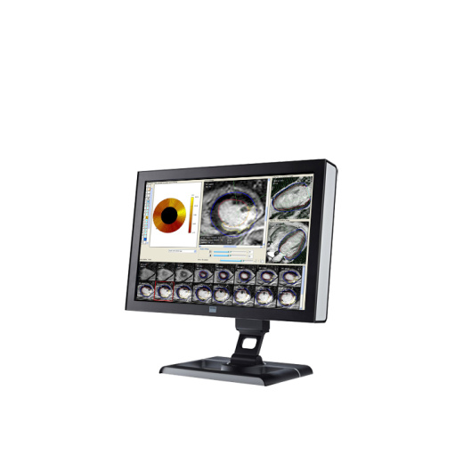 ПО для магнитно-резонансного анализа желудочков Esaote CAAS MRV