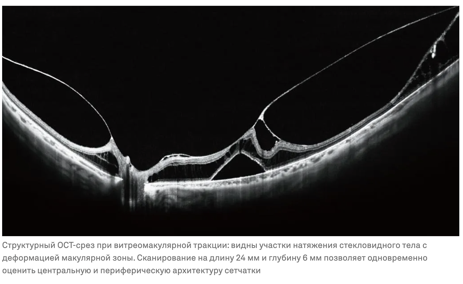 TowardPi BMizar
