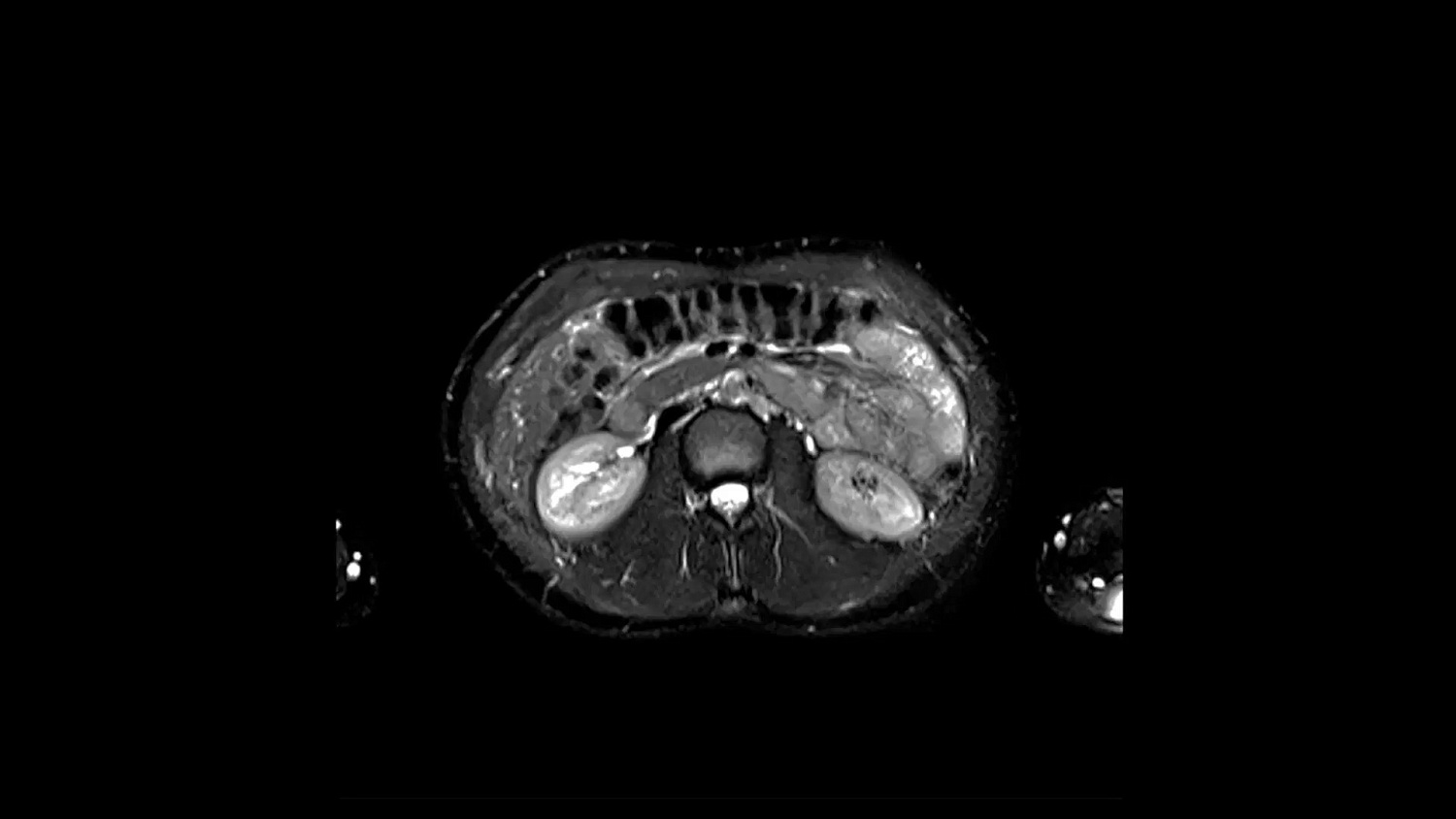Магнитно-резонансный томограф Siemens MAGNETOM Altea