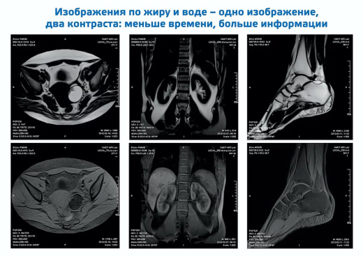 Магнитно-резонансный томограф открытого типа МРТ-АМИКО450