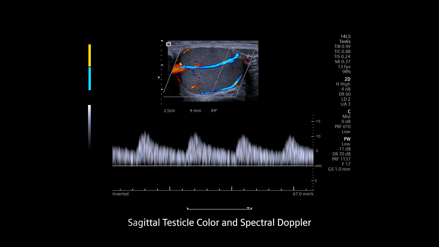 Ультразвуковая система Siemens ACUSON Redwood