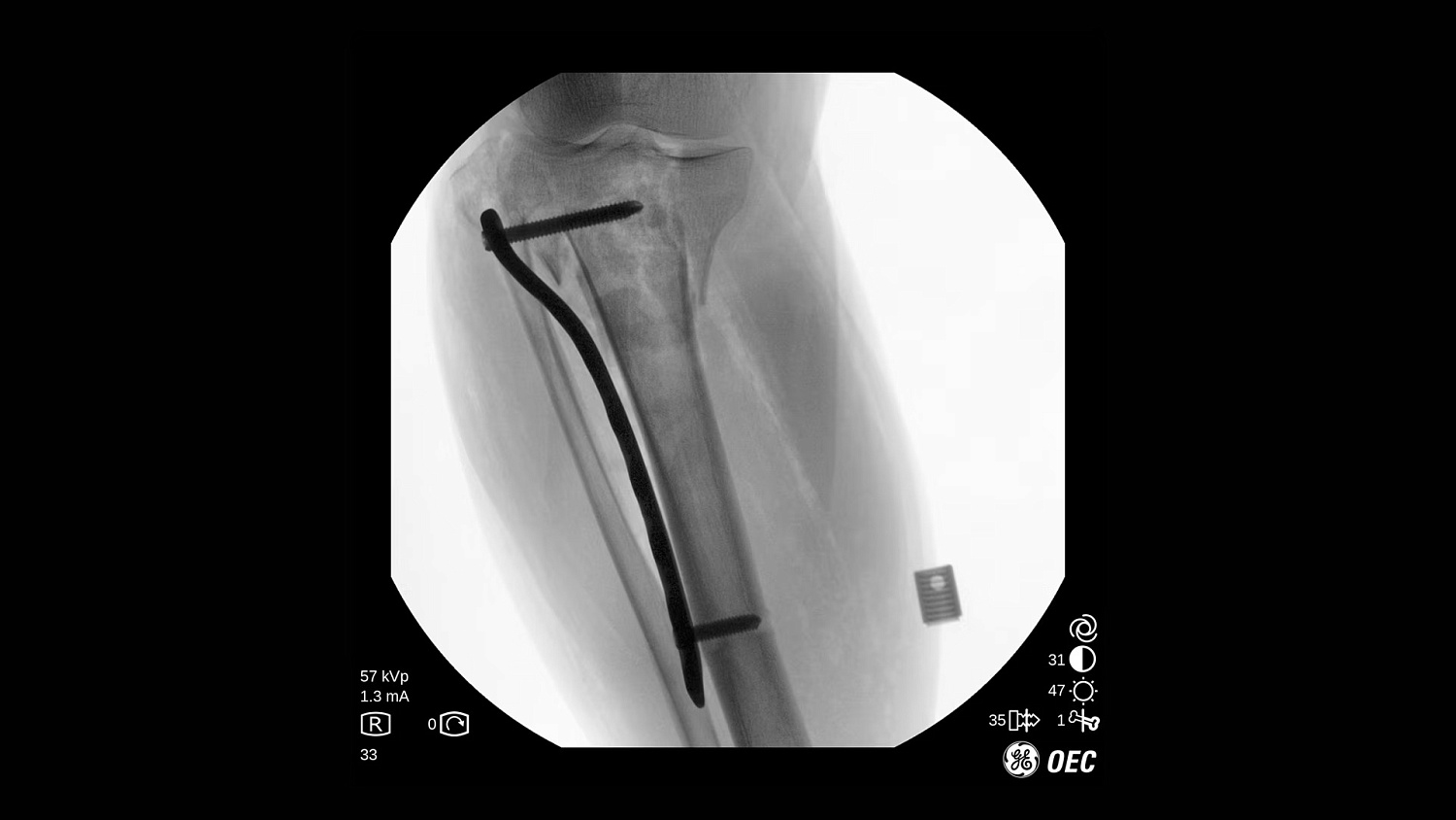 Мобильный рентгеновский аппарат с С-дугой GE OEC One CFD