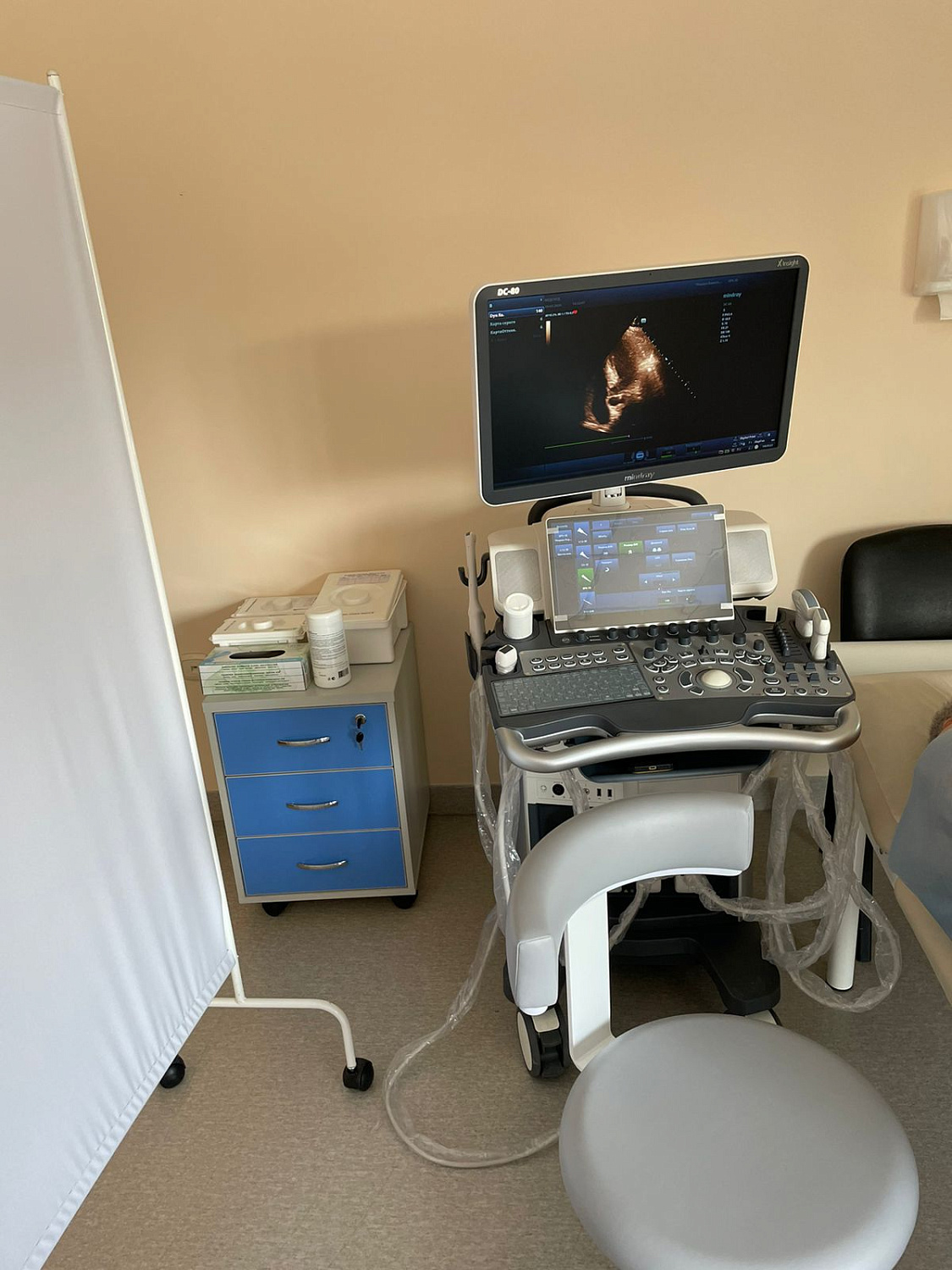 УЗИ аппарат Mindray DC-80