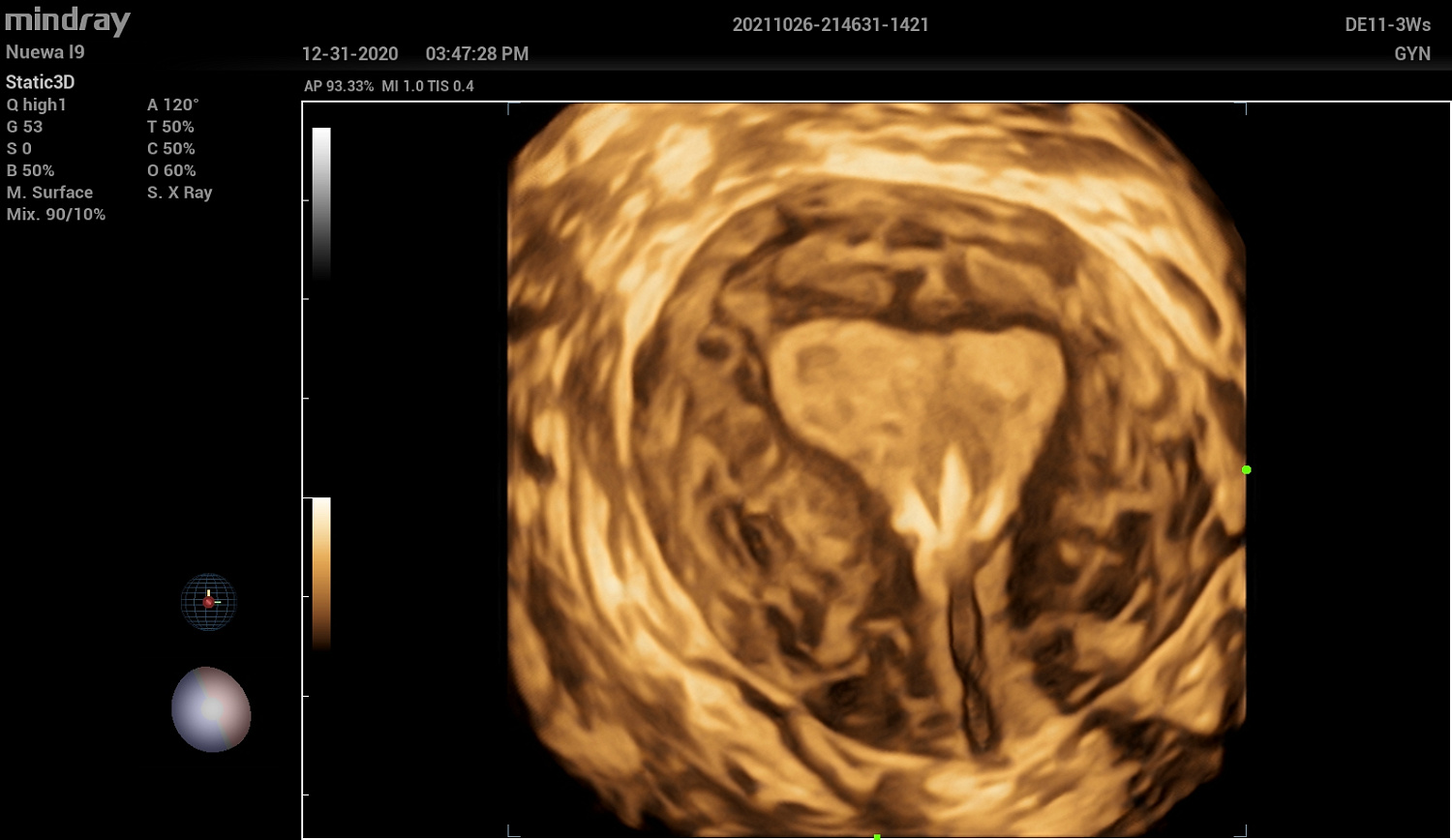 Ультразвуковой аппарат Mindray Imagyn I9