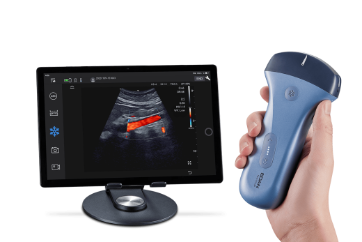 УЗИ аппарат Edan Nano C5 EXP