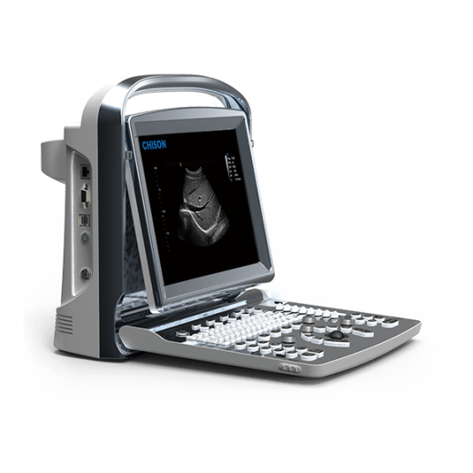 УЗИ аппарат CHISON ECO 1