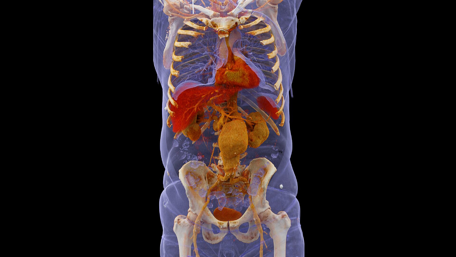 Компьютерный томограф Siemens SOMATOM Force