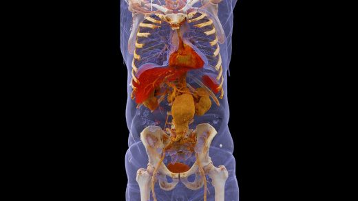 Компьютерный томограф Siemens SOMATOM Force