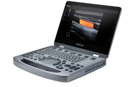 УЗИ аппарат Mindray MX3