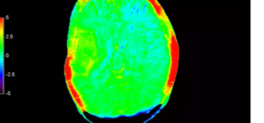 Магнитно-резонансный томограф Philips Ingenia Elition 3.0T X